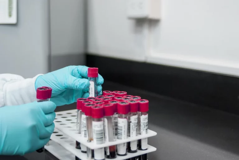 Butantan Institute Antivenom Research: Brazil’s Snake Venom Science and Why It Matters