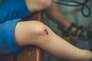 Elbow Surgery Recovery: What Tyson Fury's Former Opponent's Bruise Actually Means