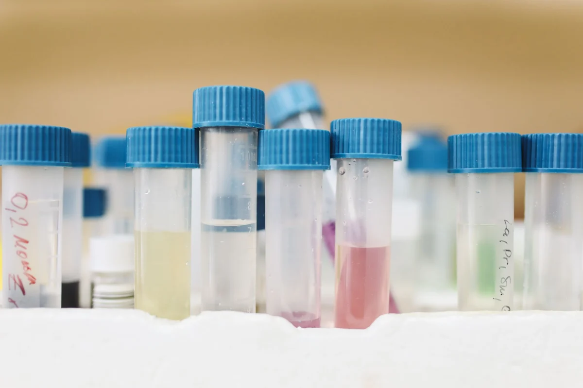 Why the First Reported Shamonda Virus Human Infection Matters